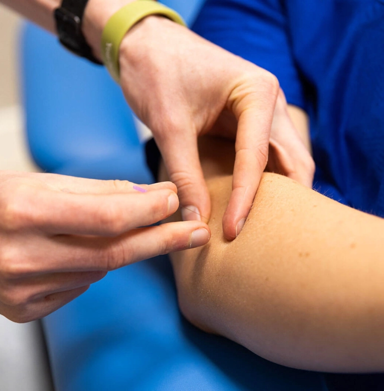 Dry needling behandeling bij Green Fit in Naarden